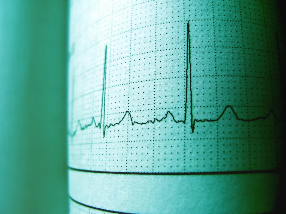 Palpitation cardiaque à Saint-Ghislain